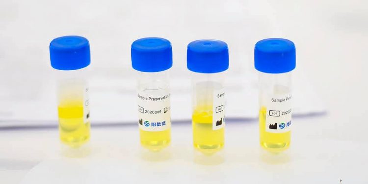 ?CONTRE-TEST – Dix cas confirmés positifs au coronavirus sur les 67 cas controversés