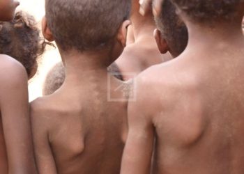 INSECURITE ALIMENTAIRE – Plus de 500.000 enfants du Sud menacés de malnutrition aiguë dont 110.000 de la forme sévère