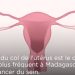 SANTE – Quand, comment et pourquoi se faire dépister du cancer du col de l’utérus ?