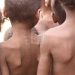 NUTRITION – 8,8 millions de Malgaches soit environ 33% de la population de Madagascar en situation d’insécurité alimentaire, selon la présentation de la Banque mondiale