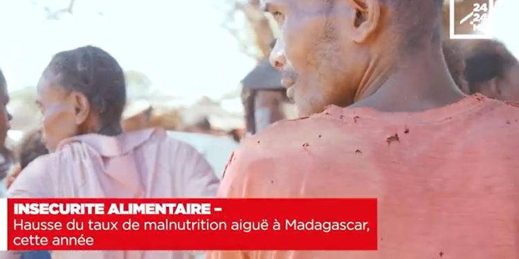INSECURITE ALIMENTAIRE – Hausse du taux de malnutrition aiguë à Madagascar, cette année