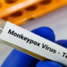 SANTE – L&rsquo;OMS déclenche son plus haut niveau d&rsquo;alerte mondiale face au virus Mpox ou la variole du singe