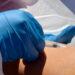 ÉPIDÉMIE – Un jeune homme de 20 ans décède de la Mpox à l’hôpital d’Andohatapenaka